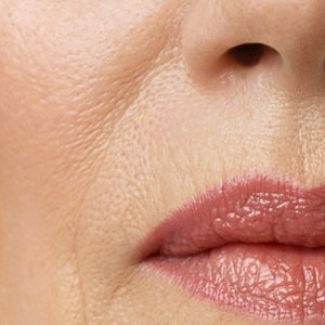 У себя под носом: 7 способов устранения морщин над верхней губой