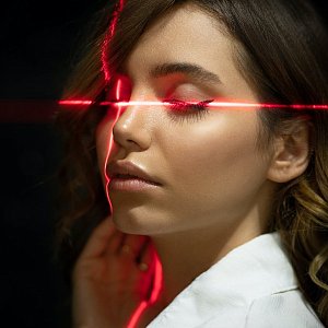 Лазерная терапия акне: мифы и правда