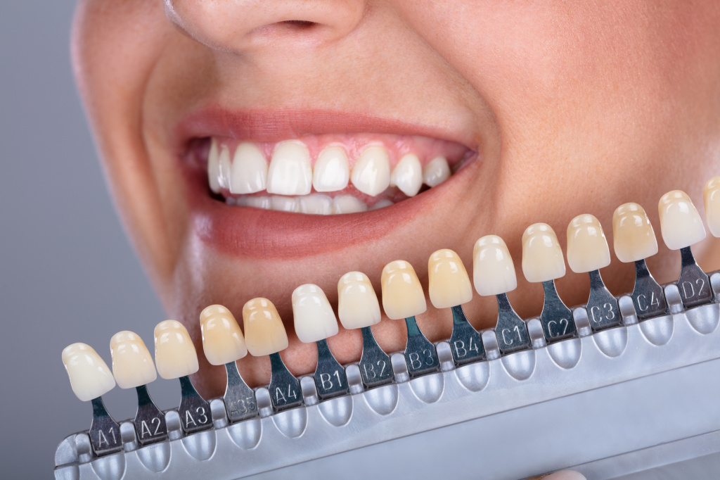 Методы домашнего отбеливания зубов