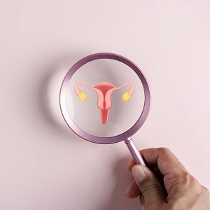 Патология шейки матки: можно ли предотвратить рак?