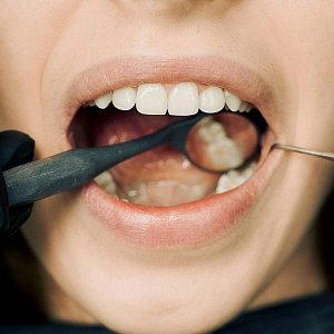 Беременность и лечение зубов: что можно и нельзя 