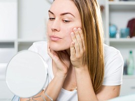 Экзема и морщины: может ли дерматологическое заболевание спровоцировать раннее старение кожи