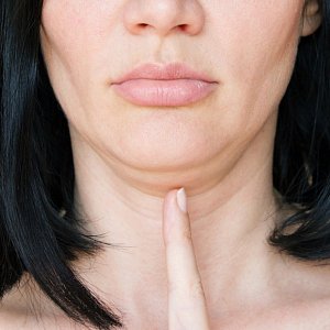 Как избавиться от двойного подбородка: 7 эффективных способов Как избавиться от двойного подбородка: 7 эффективных способов