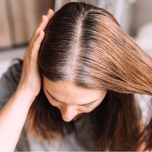 Что поможет остановить раннее поседение волос