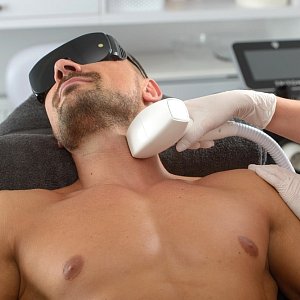 Лазерная эпиляция для мужчин: вредит ли она щитовидной железе? Лазерная эпиляция для мужчин: вредит ли она щитовидной железе?
